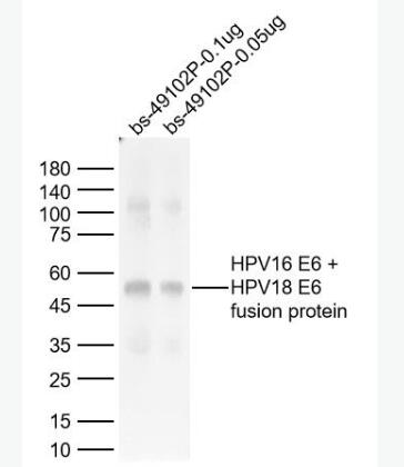 Anti-HPV16 E6 + HPV18 E6 antibody-人类乳头状瘤病毒16/18 E6抗体