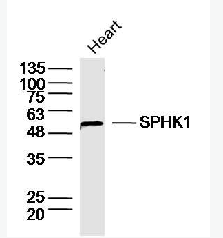 Anti-SPHK1  antibody-鞘氨醇激酶1抗体