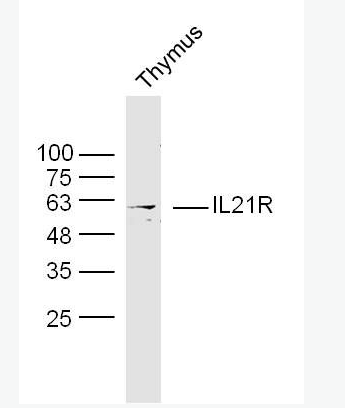 Anti-IL21R  antibody-白介素21受体抗体