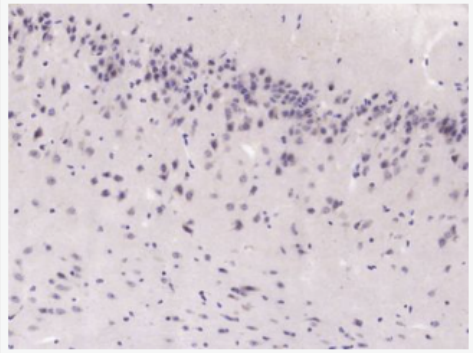 Anti-GAB2 antibody-接头蛋白Gab 2抗体