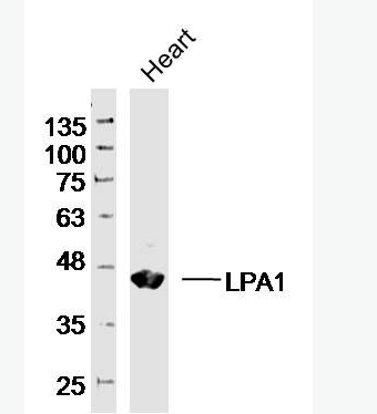 Anti-LPA1 antibody-溶血磷脂酸受体蛋白1/EDG2抗体