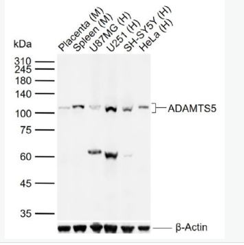Anti-ADAMTS5 antibody-软骨蛋白聚糖抗体