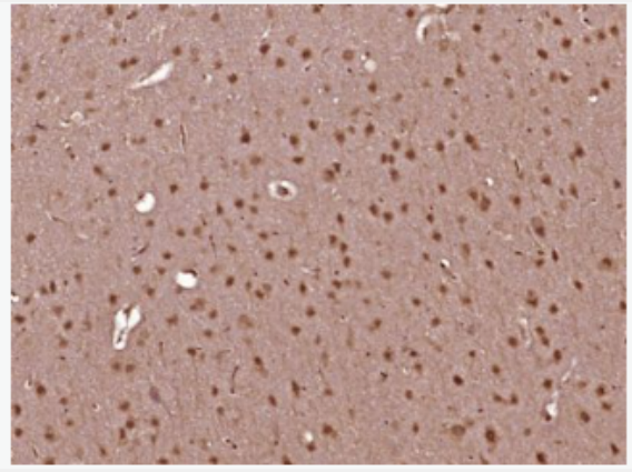 Anti-CRTC1 antibody-环腺苷酸应答元件结合蛋白转录共激活因子TORC1抗体