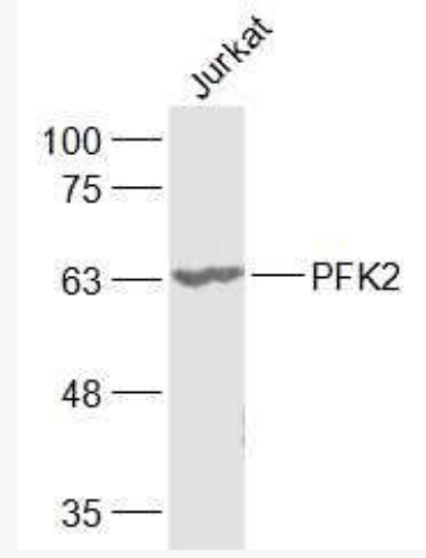 Anti-PFKFB3/PFK2 antibody-果糖-2,6-二磷酸酶3/磷酸果糖激酶2抗体