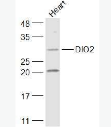 Anti-DIO2 antibody-脱碘酶2抗体