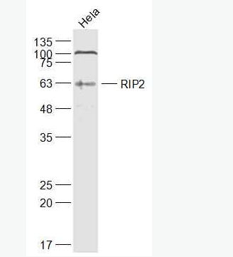 Anti-RIP2  antibody-受体结合丝氨酸苏氨酸激酶2抗体