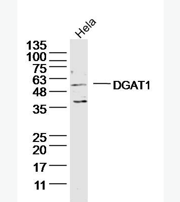 Anti-DGAT1 antibody-二脂酰甘油酰基转移酶抗体