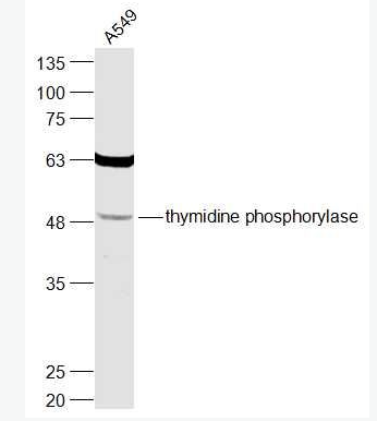 Anti-thymidine phosphorylase  antibody-胸苷磷酸化酶抗体