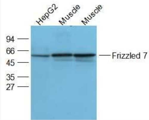Anti-Frizzled   antibody-卷曲蛋白FZD7抗体