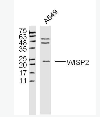 Anti-WISP2  antibody-Wnt1诱导信号通路蛋白2抗体