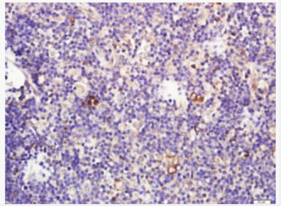 Anti-TECK antibody-胸腺表达趋化因子抗体