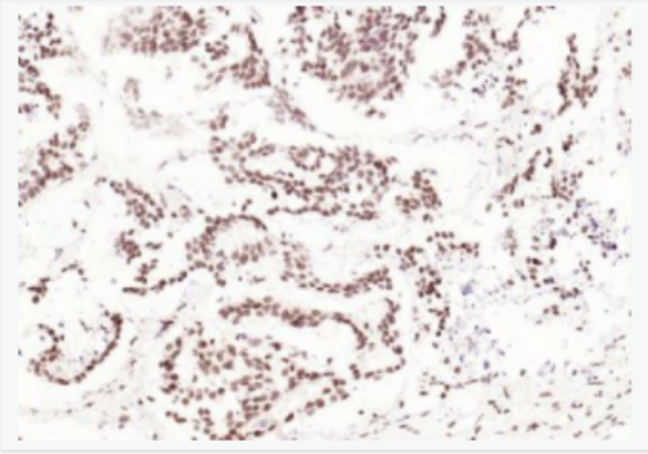 Anti-CDCA7 antibody-细胞分裂周期相关蛋白