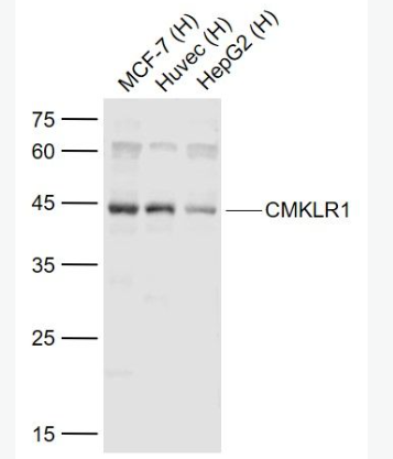 Anti-CMKLR1 antibody-趋化样因子受体1抗体