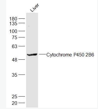 Anti-Cytochrome P450 2B6  antibody-细胞色素P450 2B6抗体