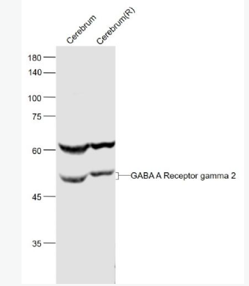 Anti-GABA A Receptor gamma 2 antibody-γ氨基丁酸γ2受体/GABAA Rγ2抗体