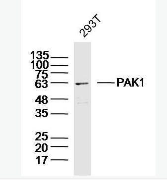 Anti-PAK1  antibody-p21激活激酶1抗体