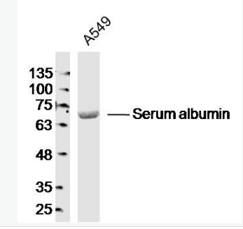 Anti-Albumin antibody-白蛋白抗体