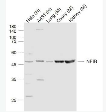 Anti-NFIB  antibody-核因子1B抗体