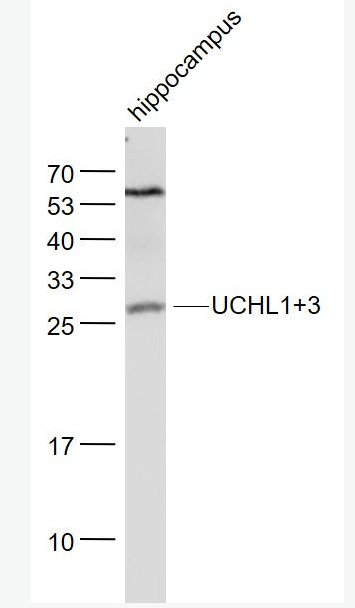 Anti-UCHL1+3 antibody-泛素硫酯酶L1+3抗体