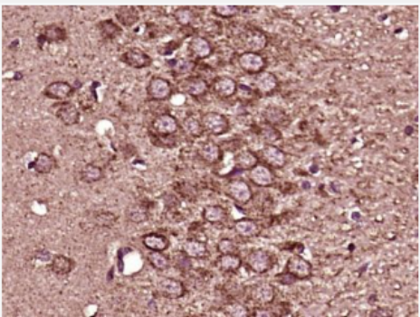 Anti-Zic1 antibody-锌指蛋白201抗体