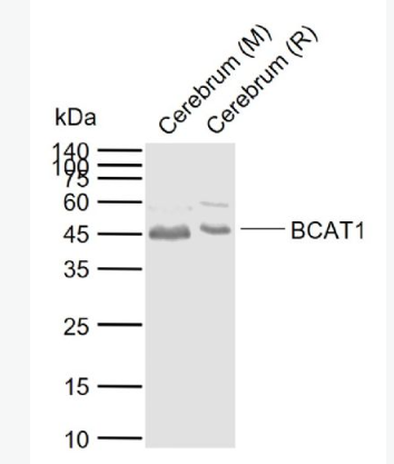 Anti-BCAT1  antibody-胞浆支链氨基酸酸转氨酶抗体