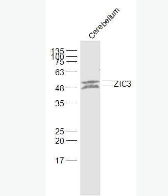 Anti-ZIC3 antibody-内脏异位相关蛋白/锌指蛋白203抗体