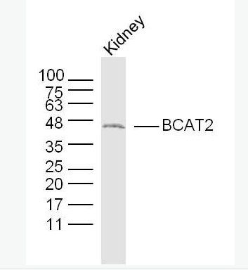 Anti-BCAT2 antibody-支链氨基酸转氨酶2抗体
