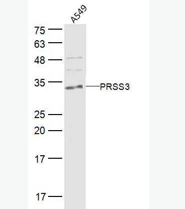 Anti-PRSS3 antibody-脑胰蛋白酶3抗体