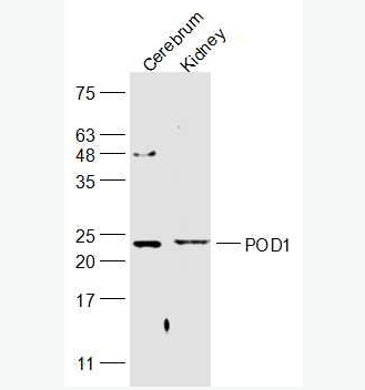 Anti-POD1 antibody-足细胞表达蛋白/转录因子21抗体