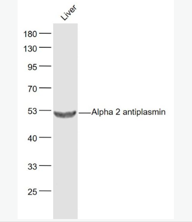 Anti-Alpha 2 antiplasmin antibody-α2纤溶酶色素上皮衍生因子抗体