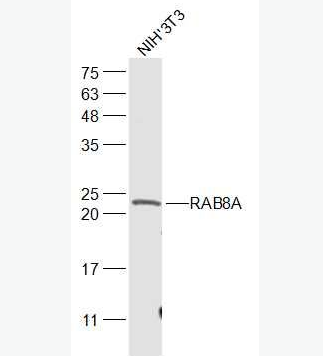 Anti-RAB8A antibody-ras癌基因家族Rab8蛋白/原癌基因c MEL抗体