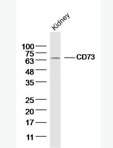 Anti-CD73 antibody-CD73抗体