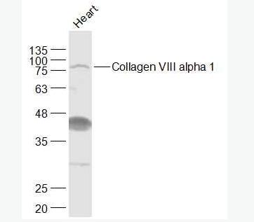 Anti-Collagen VIII alpha 1  antibody-8型胶原/内皮胶原蛋白抗体