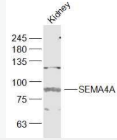 Anti-SEMA4A antibody-跨膜蛋白SEMA4A抗体