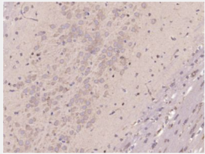 Anti-Ribonuclease Inhibitor  antibody-核糖核酸酶抑制因子1抗体