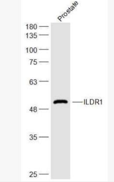 Anti-ILDR1 antibody-免疫球蛋白样结构域受体1抗体