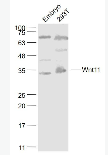 Anti-Wnt11 antibody-信号通路Wnt11抗体
