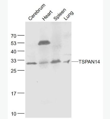 Anti-TSPAN14  antibody-四分子交联体14抗体（四旋蛋白）