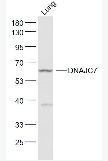 Anti-DNAJC7  antibody-DNAJC7蛋白抗体