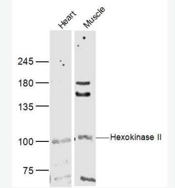 Anti-Hexokinase II antibody-己糖激酶2抗体