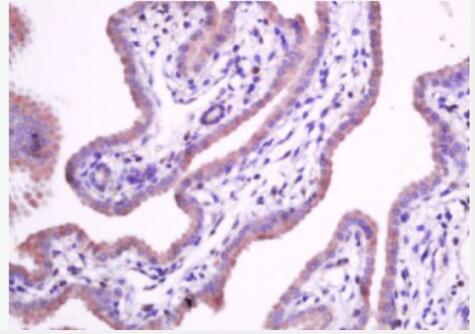 Anti-Integrin alpha 5 antibody-整合素α5（CD49e）抗体