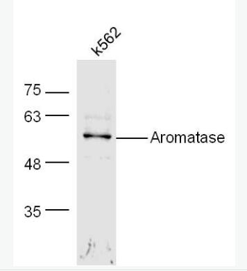 Anti-Aromatase antibody-芳香化酶/细胞色素P450/雌激素合成酶抗体