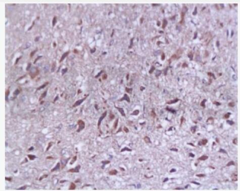 Anti-SYAP1  antibody-突触相关蛋白-1抗体