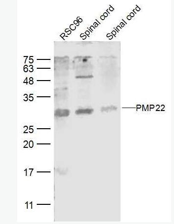 Anti-MMP1 antibody-外基质金属蛋白酶-1抗体