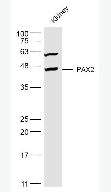 Anti-PAX2 antibody-配对盒基因2抗体