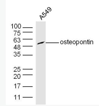 Anti-Osteopontin antibody-骨桥蛋白/分泌型磷蛋白1抗体