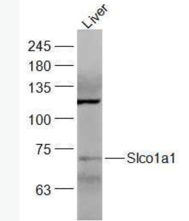 Anti-Slco1a1 antibody-外溶质载体有机阴离子转运蛋白家族成员1A1抗体