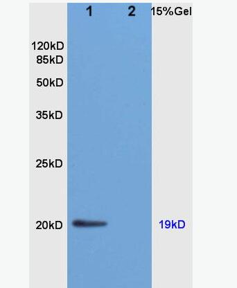 Anti-Nociceptin antibody-孤菲肽/痛敏肽抗体