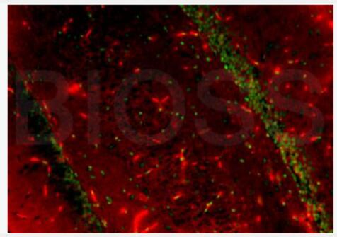 Anti-BrdU(Proliferation Marker)  antibody-5-溴脱氧尿嘧啶核苷（增殖标志物）单克隆抗体