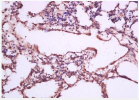 Anti-CFTRantibody-囊性纤维化跨膜转运调节因子抗体